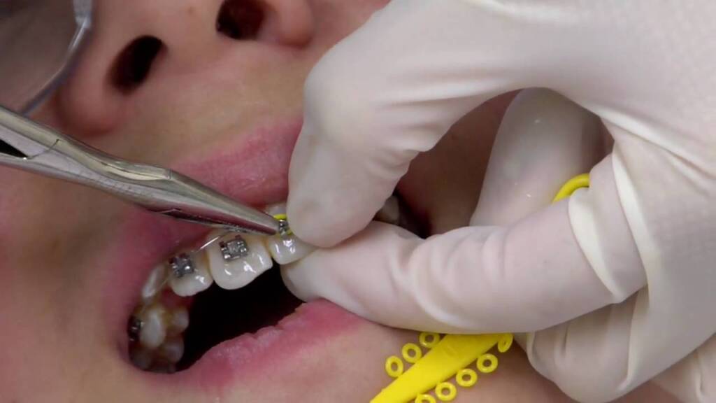 Woodbridge Orthodontists, Dale City Orthodontist, Dale City Orthodontics, Burke Orthodontists