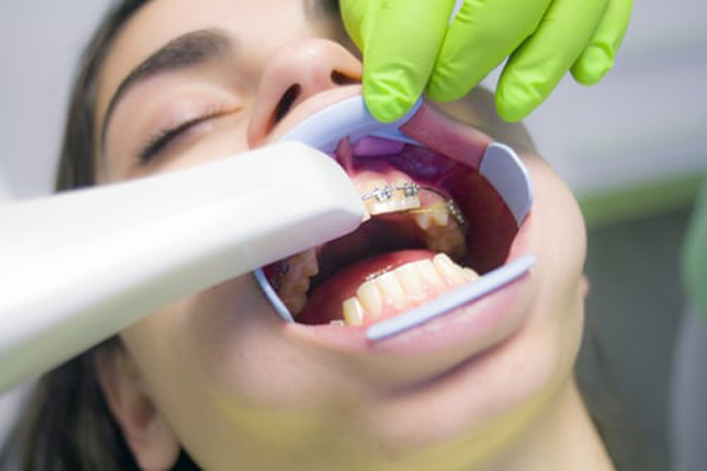 Teen Orthodontic Options
