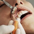 Benefits of Choosing Pediatric Dentists