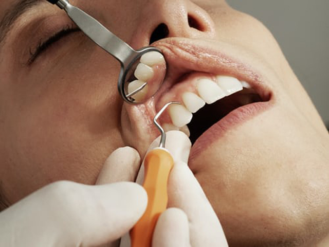 Teen Dental Problems on the Rise after Covid