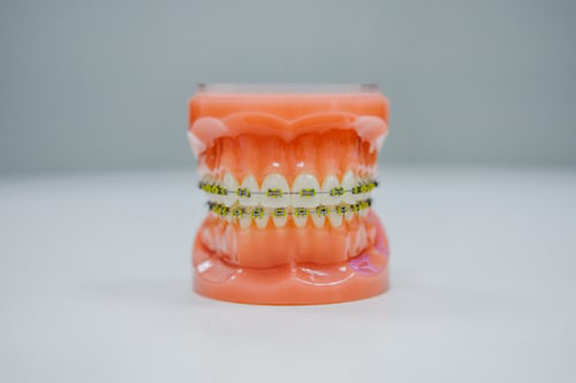 Invisalign Coming to Golden Pediatric Dentistry & Orthodontics