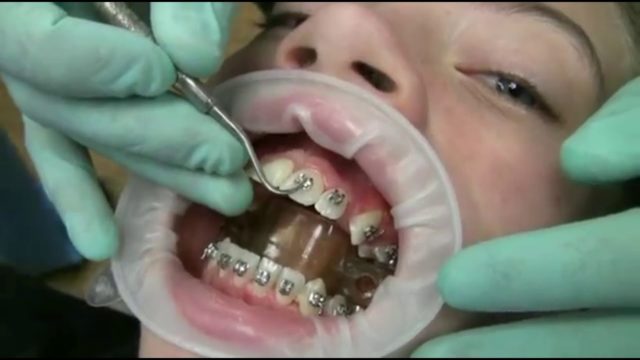 Top 10 Pediatric Dental Issues