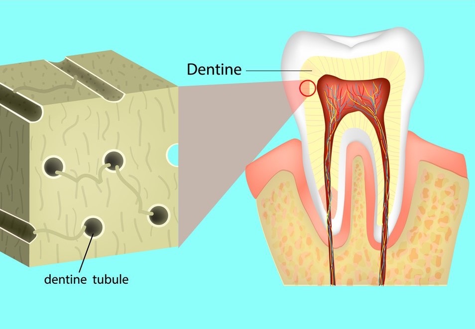 A diagram of a tooth, Tooth Sensitivity