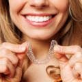 Clear Aligners in Burke: Are They the Right Choice for Your Smile?